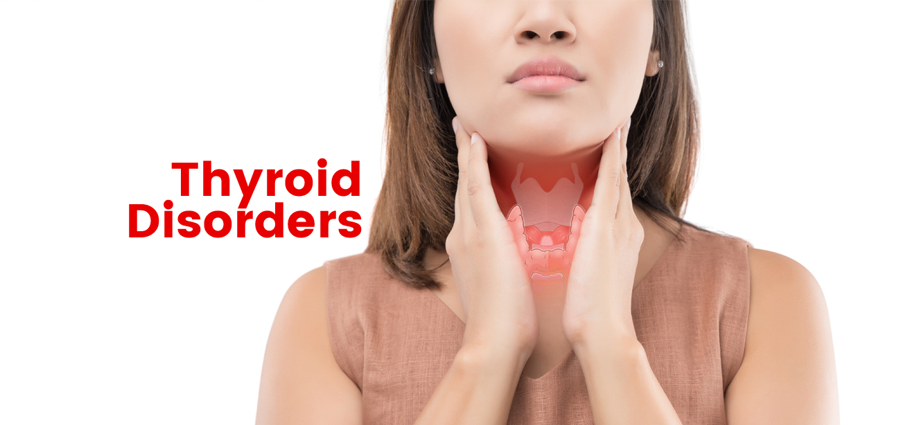 Thyroid Disorders